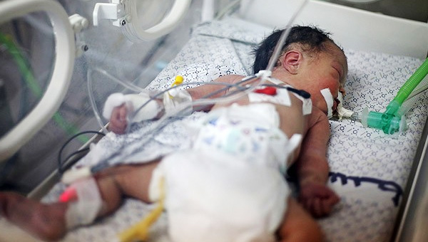 Gazzeli ''eyma'' bebek hayata tutunamad