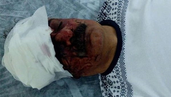 iyager'e PKK'llardan irkin saldr