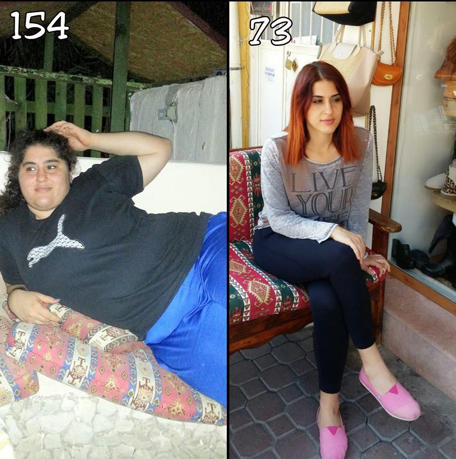Yaşlılığını düşünüp, 81 kilo verdi
