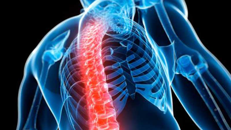 10 soruda osteoporoz riskinizi renin 
