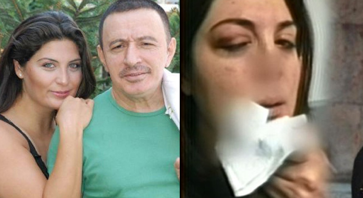 Mustafa Topalolu ei Derya Topalolu'nu hastanelik etti
