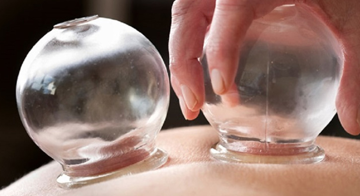 Devlet hastanelerinde hacamat tedavisi