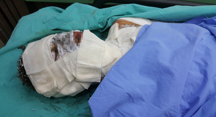 Sobaya d�k�len tiner hastanelik etti