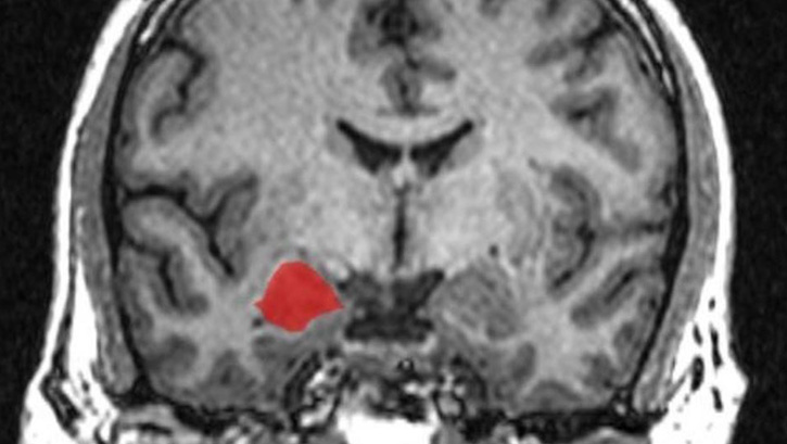 Kad�nlar�n erkeklerden daha duygusal olmad��� kan�tland�