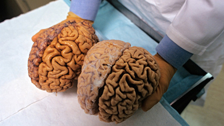 Beyindeki k�vr�mlar, ki�ilik �zelliklerimizi ortaya koyuyor