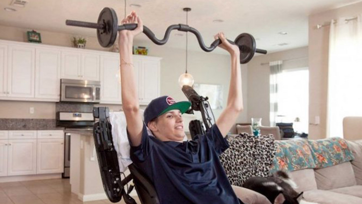 Fel�li hastada 'k�k h�cre' tedavisi yan�t verdi