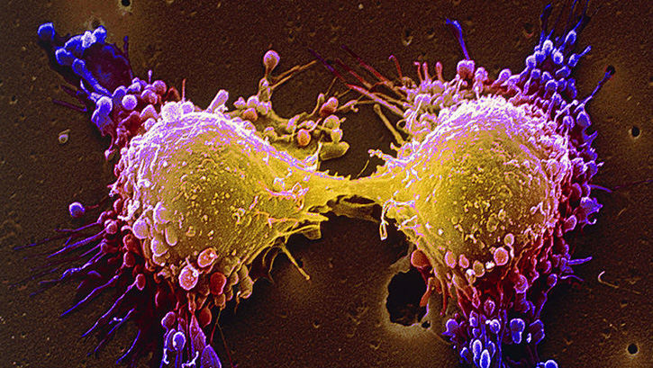 Bilim insanlar�n� heyecanland�ran kanser ilac�