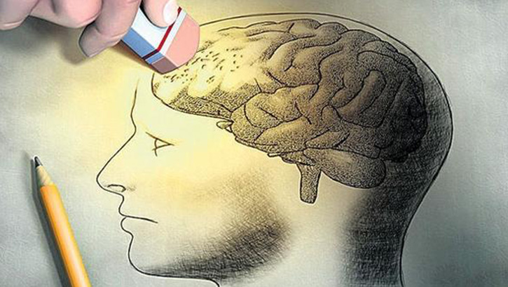 Beyinden k�t� an�lar� silmeyi ba�ard�lar