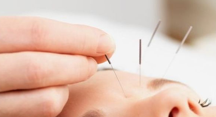 Devlet hastanesinde akupunktur d�nemi 