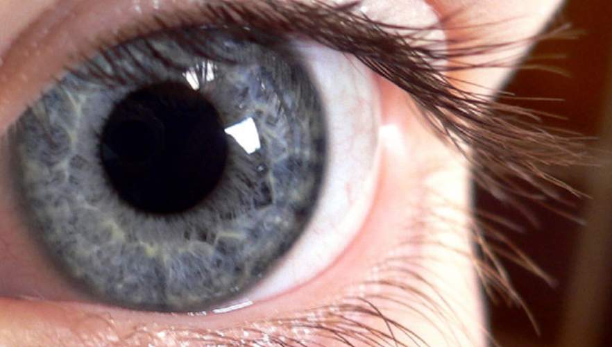 �eker hastal��� olanlarda g�zlere dikkat