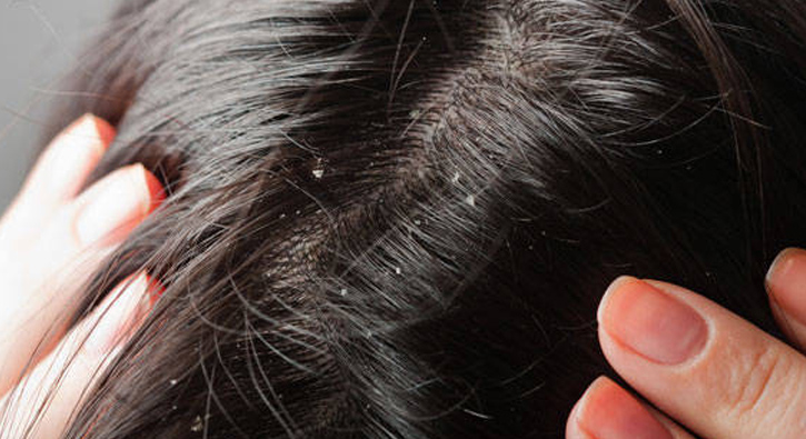 Sa�taki kepek nas�l ge�er?