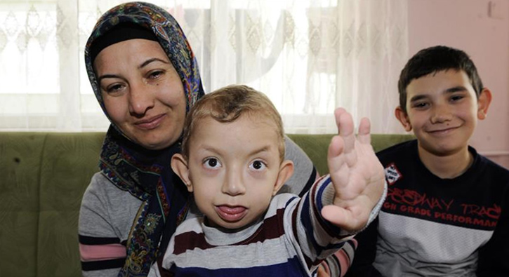 'Mucize �ocuk' Samet yard�m bekliyor