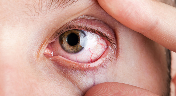 G�z kurulu�unun nedeni potasyum eksikli�i olabilir