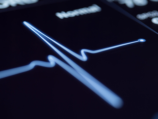 Yapay zeka kalp krizi tahminlerinde doktorlardan daha baarl