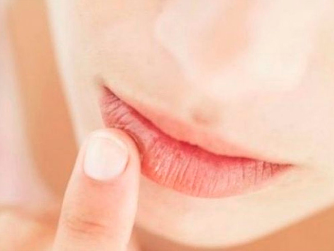 U�uklardan kurtulman�n do�al yollar�