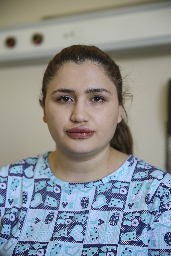 ''Estetik'' ma�duru hem�ire taburcu edilecek