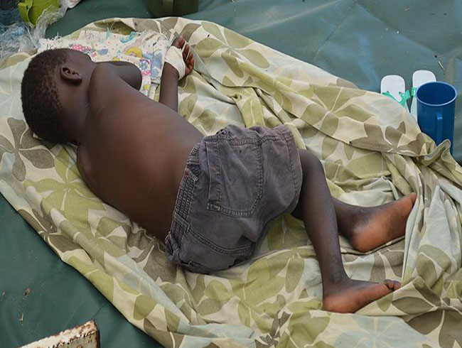 Yemen'deki kolera salgn yaylyor: 398 kii hayatn kaybetti