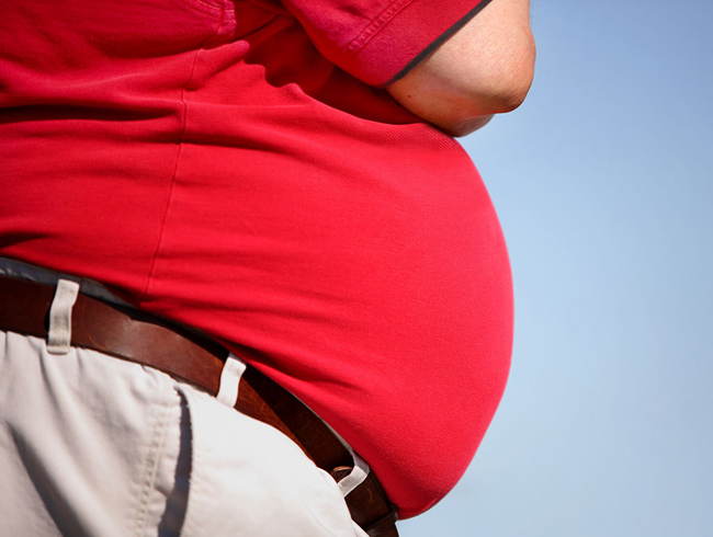 Obezite ameliyat geirmi hastalara Ramazan nerileri
