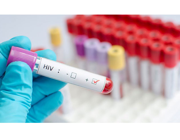 Biyologlar AIDS�e yol a�an vir�s�n sakland��� h�creleri tespit etmeyi ba�ard�