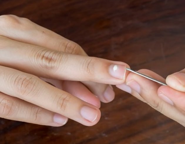 T�rnaklardaki beyaz lekenin nedeni ve ��z�m�