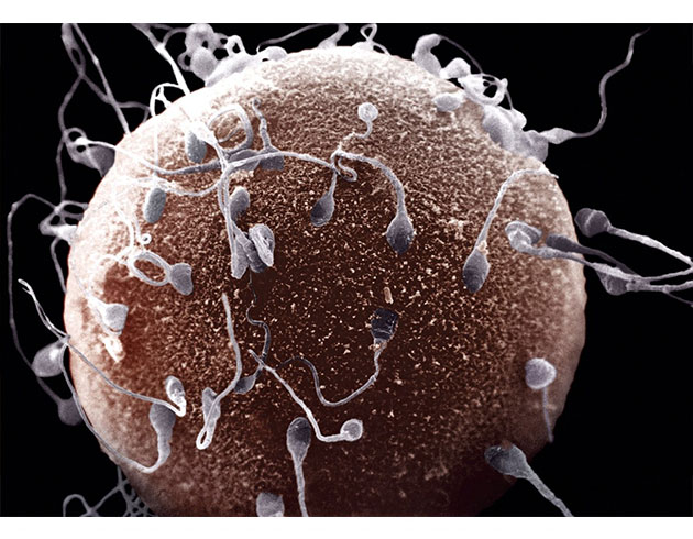 Sperm saysnn mevcut oranda azalmas insanln sonunu getirebilir