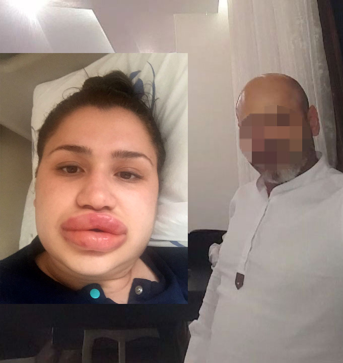 Sahte estetikiye 2 dava daha ald