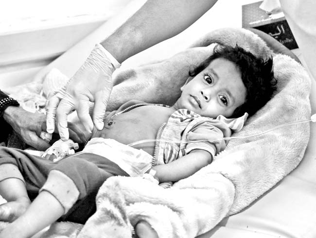 Yemen�deki ac� bilan�oya d�nya sessiz