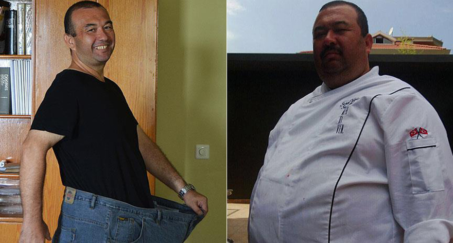 Obezite cerrahisinin ardndan 65 kilo verip yeni bir hayata balad