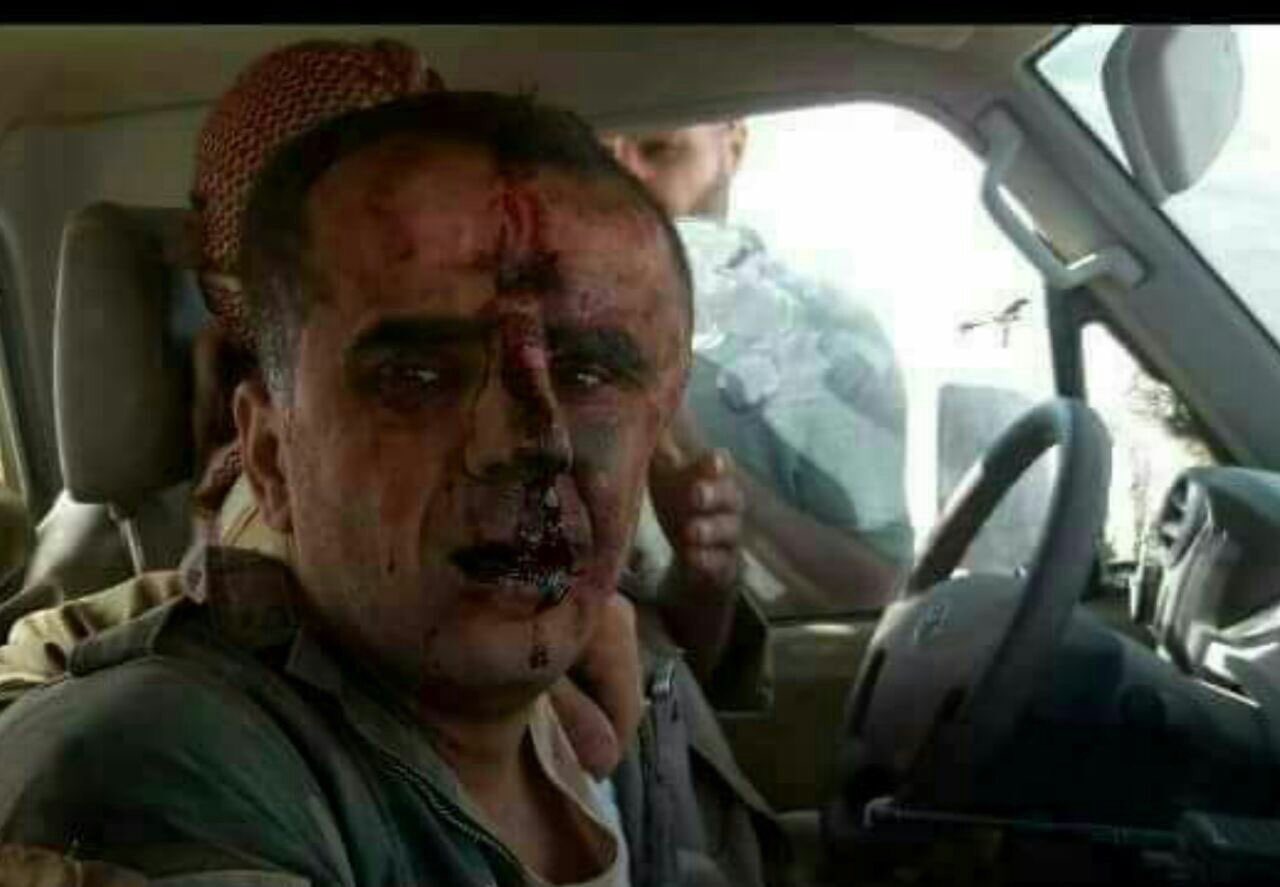 Esed rejimine ait u�ak d���r�ld�