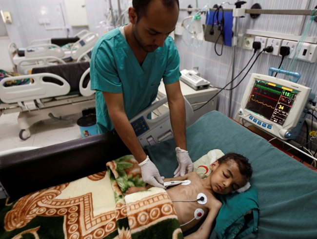 Yemen'de kolera salgn nedeniyle 2 bin 127 kii hayatn kaybetti