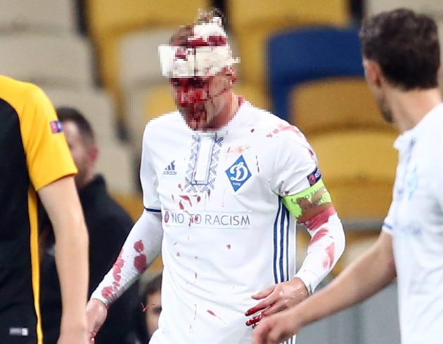Dynamo Kiev, Domagoj Vida'nn kafasna 10 diki atldn, oyuncunun durumunun iyi olduunu duyurdu