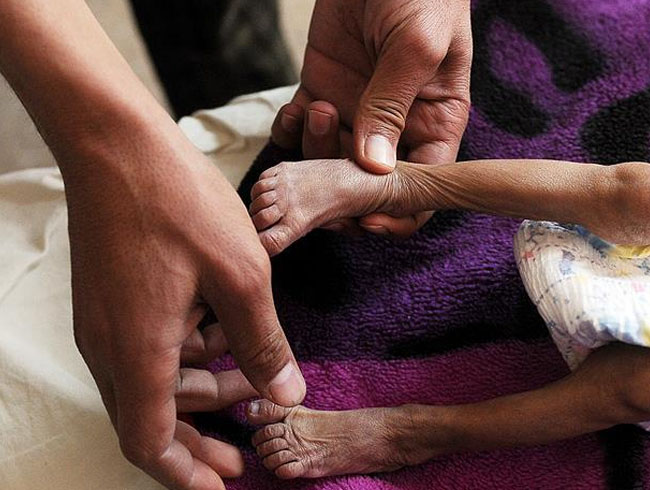 Yemen ablukas nc haftasnda