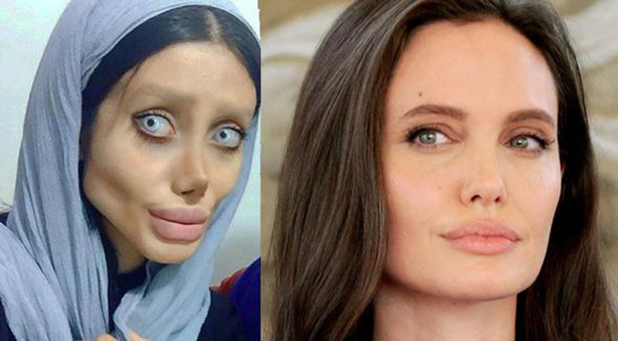 Angelina Jolie'ye benzemek iin servet harcad, son hali grenleri oke etti
