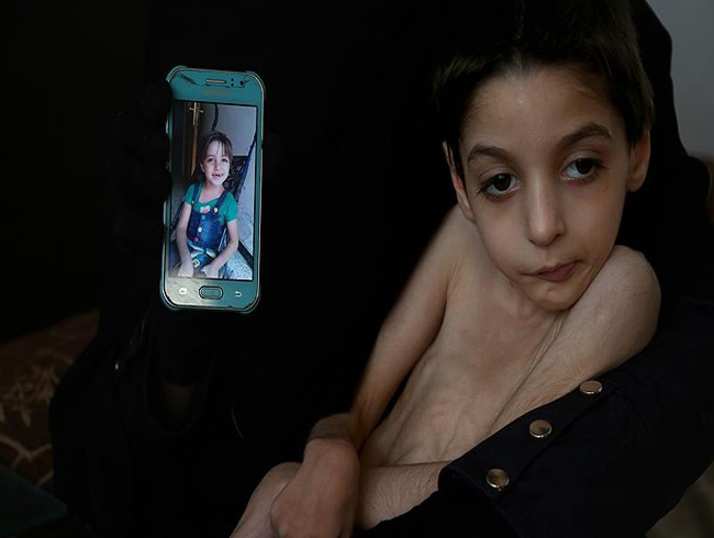 UNICEF'ten Do�u Guta uyar�s�