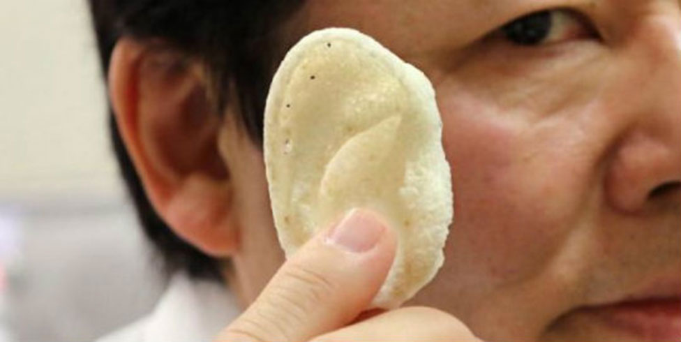 3D bask� i�itme kayb�n� tedavi edebilir