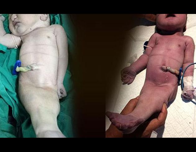 Hindistan'da 'denizk�z�' do�du