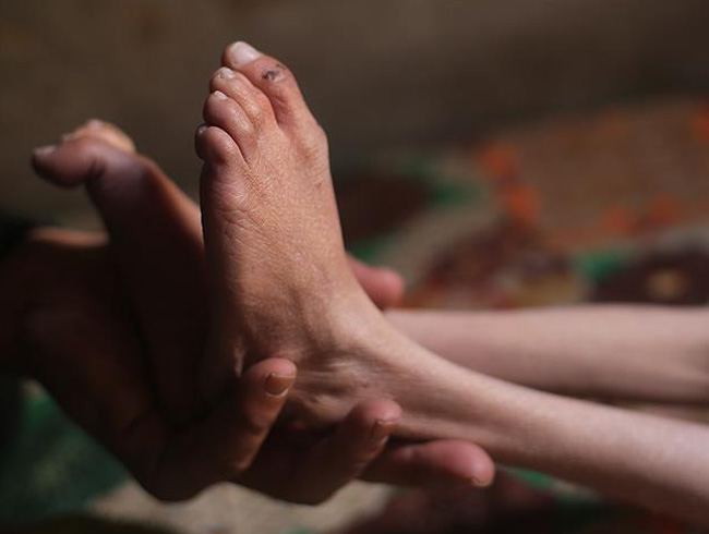 Do�u Guta'daki insani durum 'kritik noktaya' ula�t�