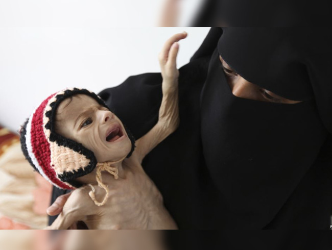 WHO, WFP ve UNICEF'ten Yemen raporu: Nfusun yzde 75'i insani yardma ihtiya duyuyor