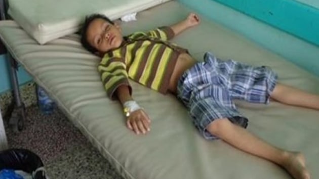 Yemen'de difteri salgn nedeniyle 62 kiinin hayatn kaybetti