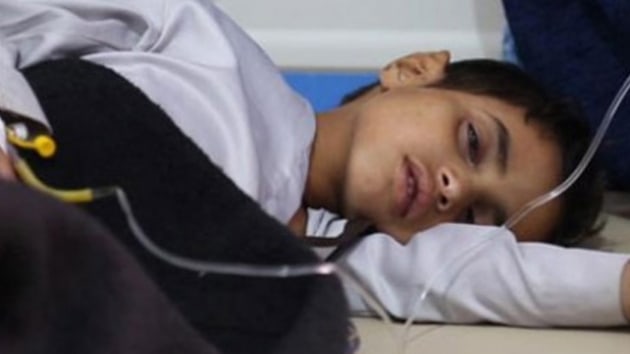 Yemen'de bin 300 kii difteri hastalna yakaland
