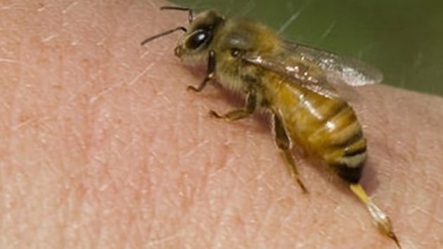 Ar sokmasna bal ciddi alerjik reaksiyonlar lme sebep olabilir