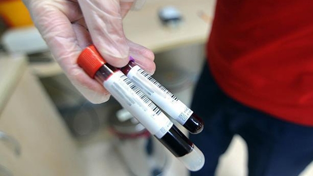 Kan testiyle erken doum riski tahmin edilebilecek
