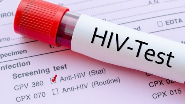 Vietnam'da tkrkle HIV testi uygulamas balayacak   