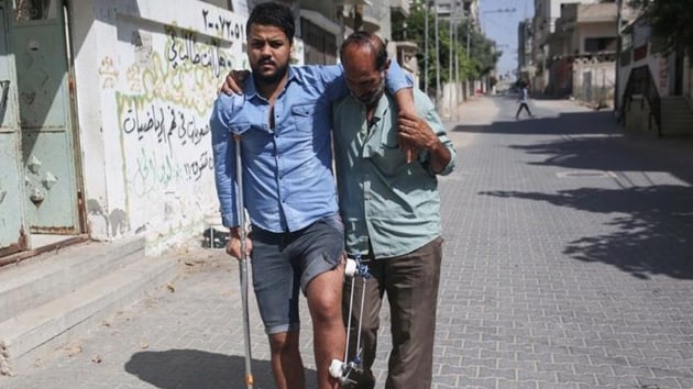Bacan kaybetme riski tayan Gazzeli berber destek bekliyor