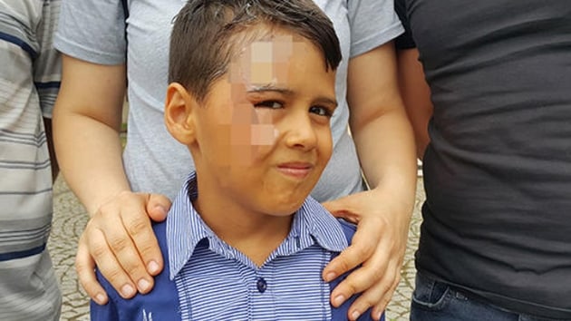Bursa'da bir ocuun otobste yolculuu srasnda muavin tarafndan yzne kaynar su dkld