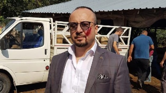 Koyunlar hacze giden avukat yanandan srld