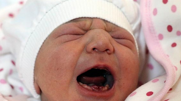 Amasya'da dokuz di�li bebek d�nyaya geldi
