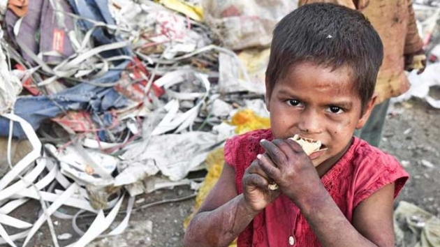 'Yemen'de 2,2 milyon ocuk yetersiz beslenme sorunu yayor'