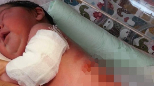 Bebeklerinin doumhanede elektrikli stcnn yanna konulmas nedeniyle yandn syleyen aile su duyurusunda bulundu