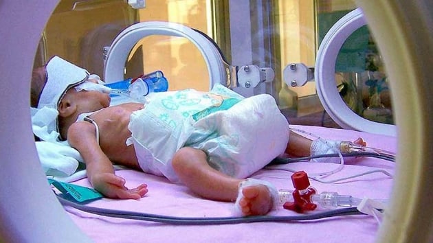 Trkiye'de her 10 bebekten biri hayata erken balyor